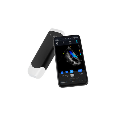 Pemindai Ultrasound Tipe Probe Nirkabel Genggam Portabel 2mhz