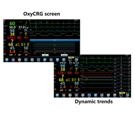 Peralatan Pemantauan Anestesi Portabel Oxygen Analyzer TFT 15.6&quot; LCD